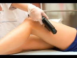 Laser Therapy for Vein Treatment: Vein Center NYC